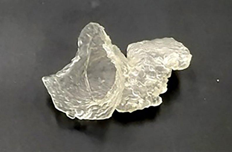 3D printed left atrial appendage model