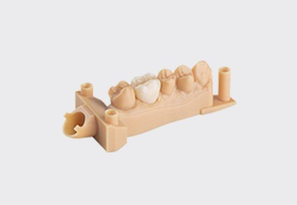 Crown and bridges model - 3D printing
