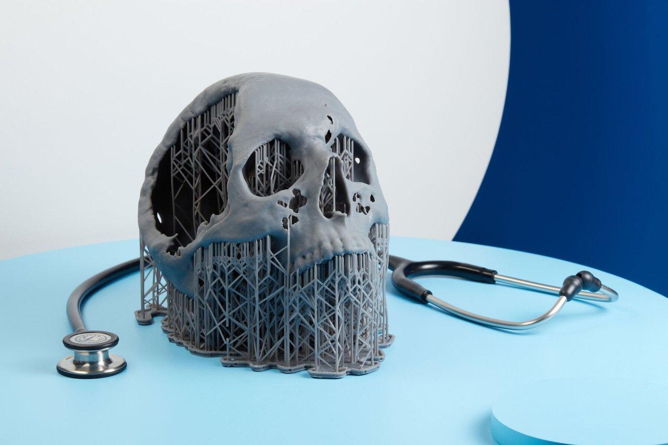 3D-printed model of a skull in medical quality