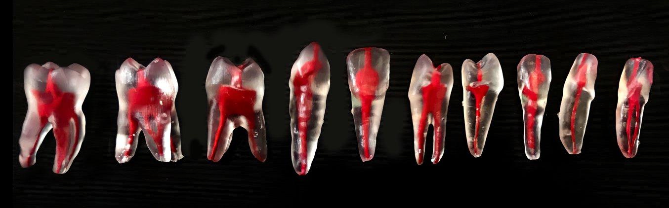 3D printed teaching aids: Multiple views of clear 3D printed teeth, with red coloring in interior channels to simulate living tissue.