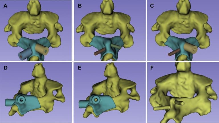 the steps used during the boolean operations