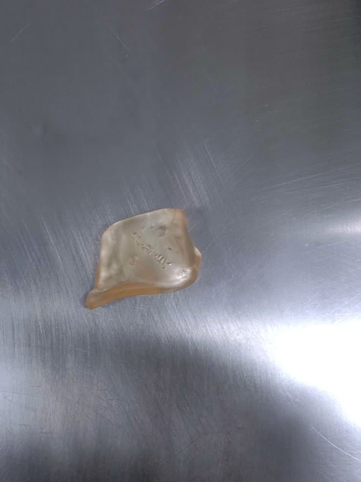 The surgical guide for the mandible printed in BioMed Amber Resin using the Formlabs 3B+ printer. Source: Jajal Medical.
