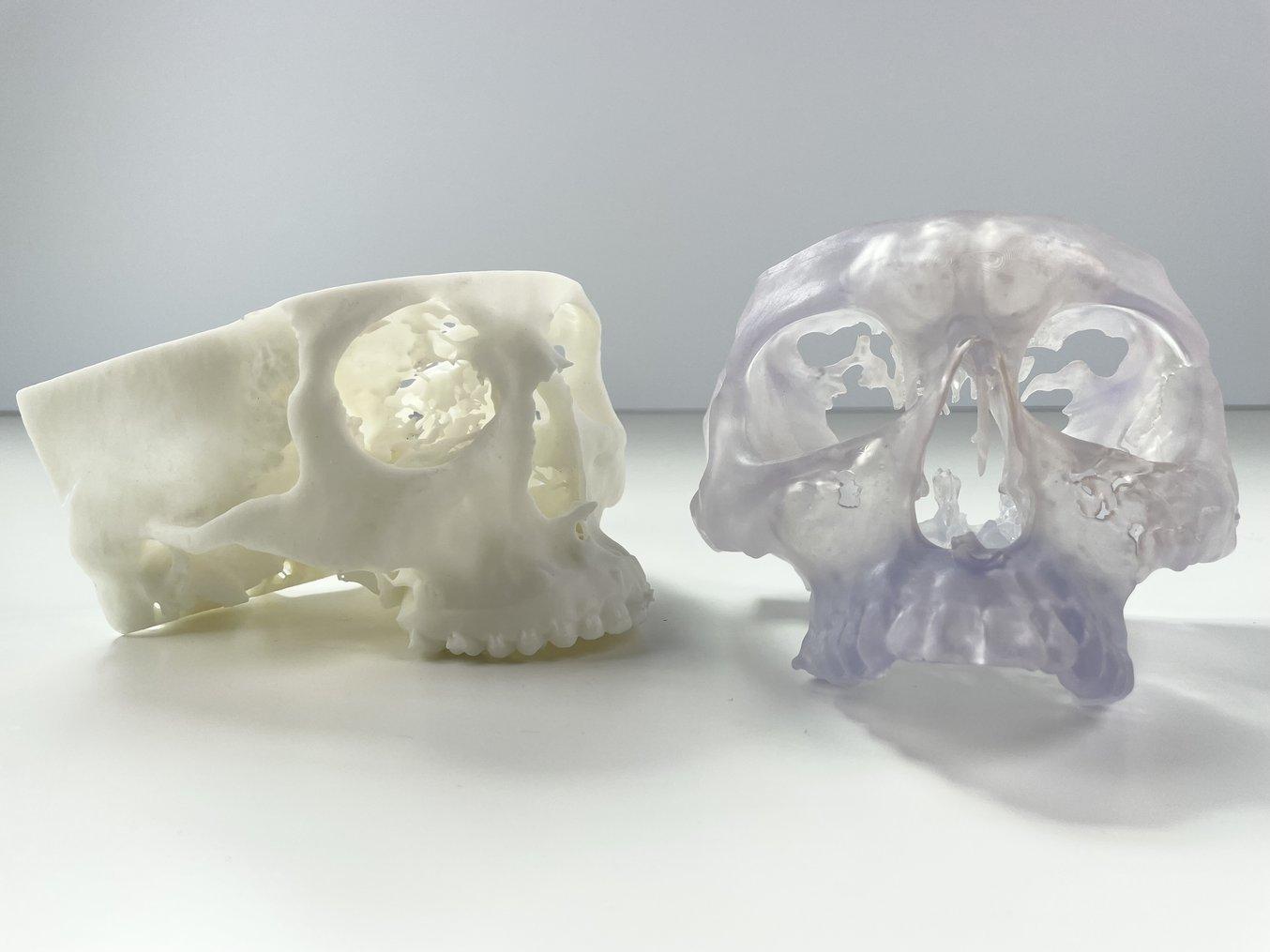 Two 3D printed anatomical models of the upper jaw and eye sockets, printed in white and clear resin. One is a side view, the other front view