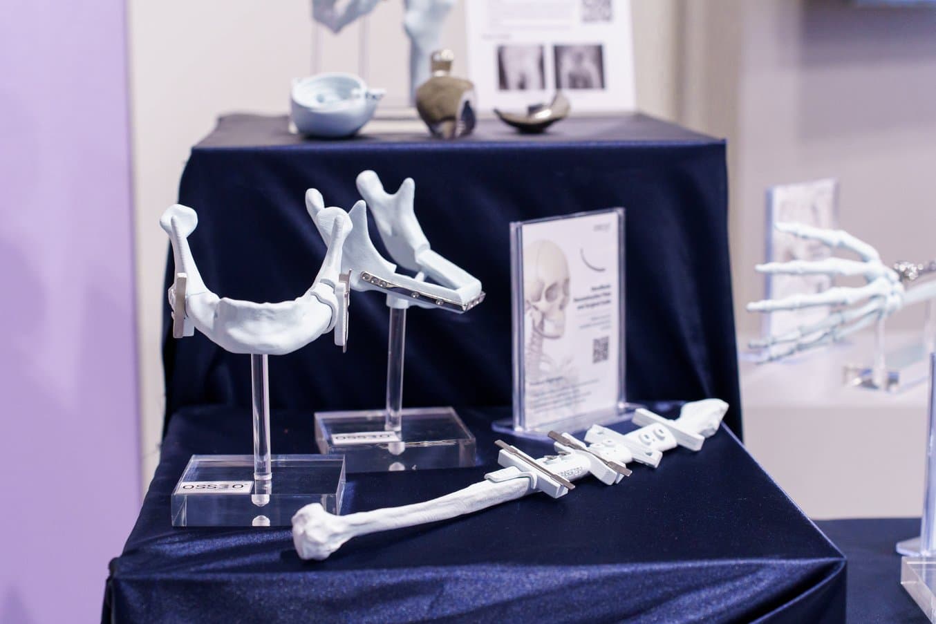 3d printed mandible