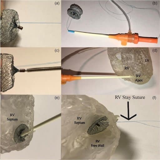 Suture thread on a 3D model of a heart