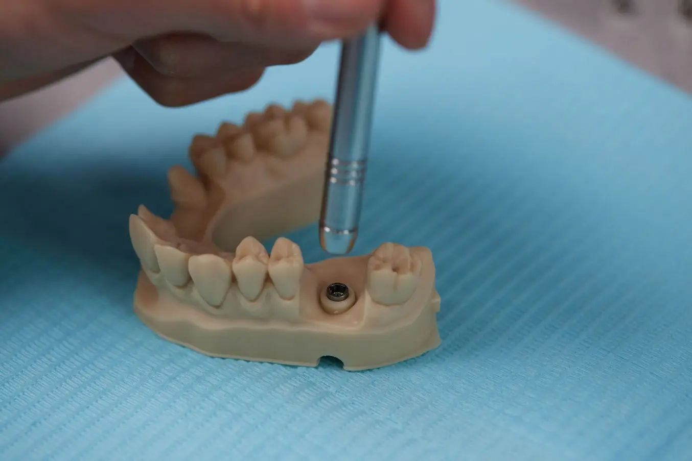 Le matériau Precision Model Resin de Formlabs pour les pièces dentaires