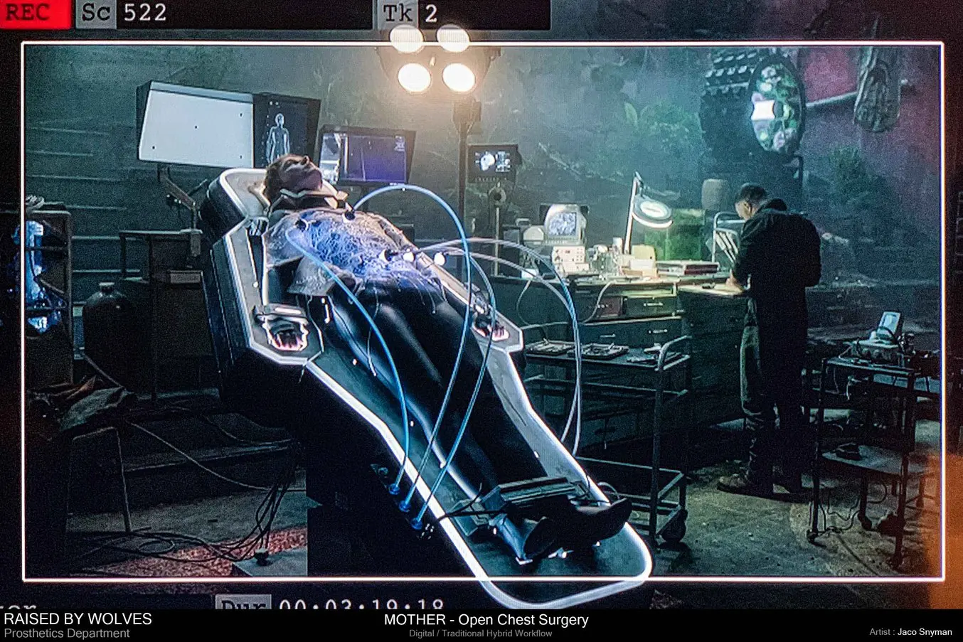 Die fertige aus Elastic 50A Resin gedruckte Androidenhaut in der Szene mit der offenen Brust-OP in der Fernsehserie “Raised by Wolves”.