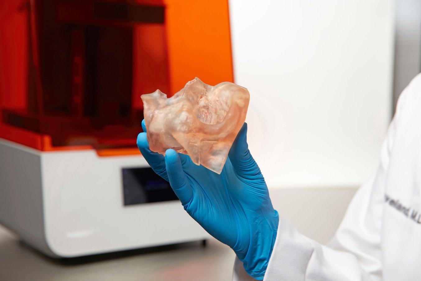 Person wearing gloves holding an anatomical model in front of a Form 3B 3D printer