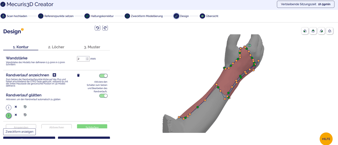 Digital model of an arm orthosis in Mecuris3D Creator