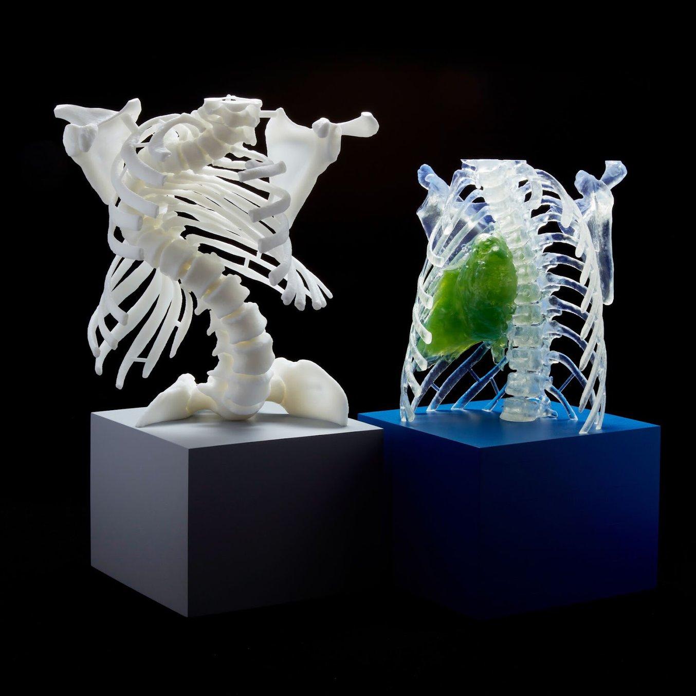 An adult spine 3D printed on the Form 3L in White Resin and a pediatric rib cage printed on the Form 3L in Clear Resin.