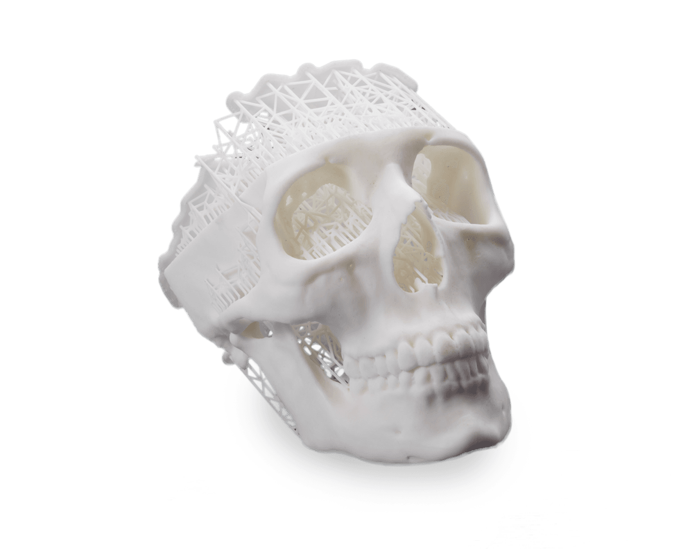 Skull with supports printed in White Resin