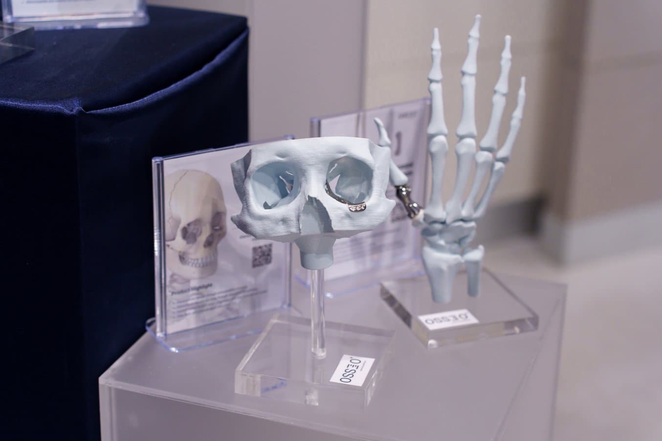 3d printed model of eye sockets with a 3d printed model of a hand skeleton in the background