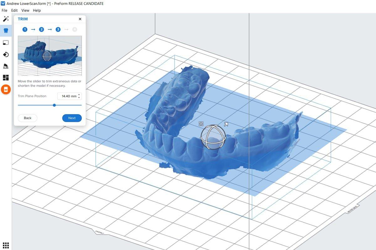 dental model trim - software