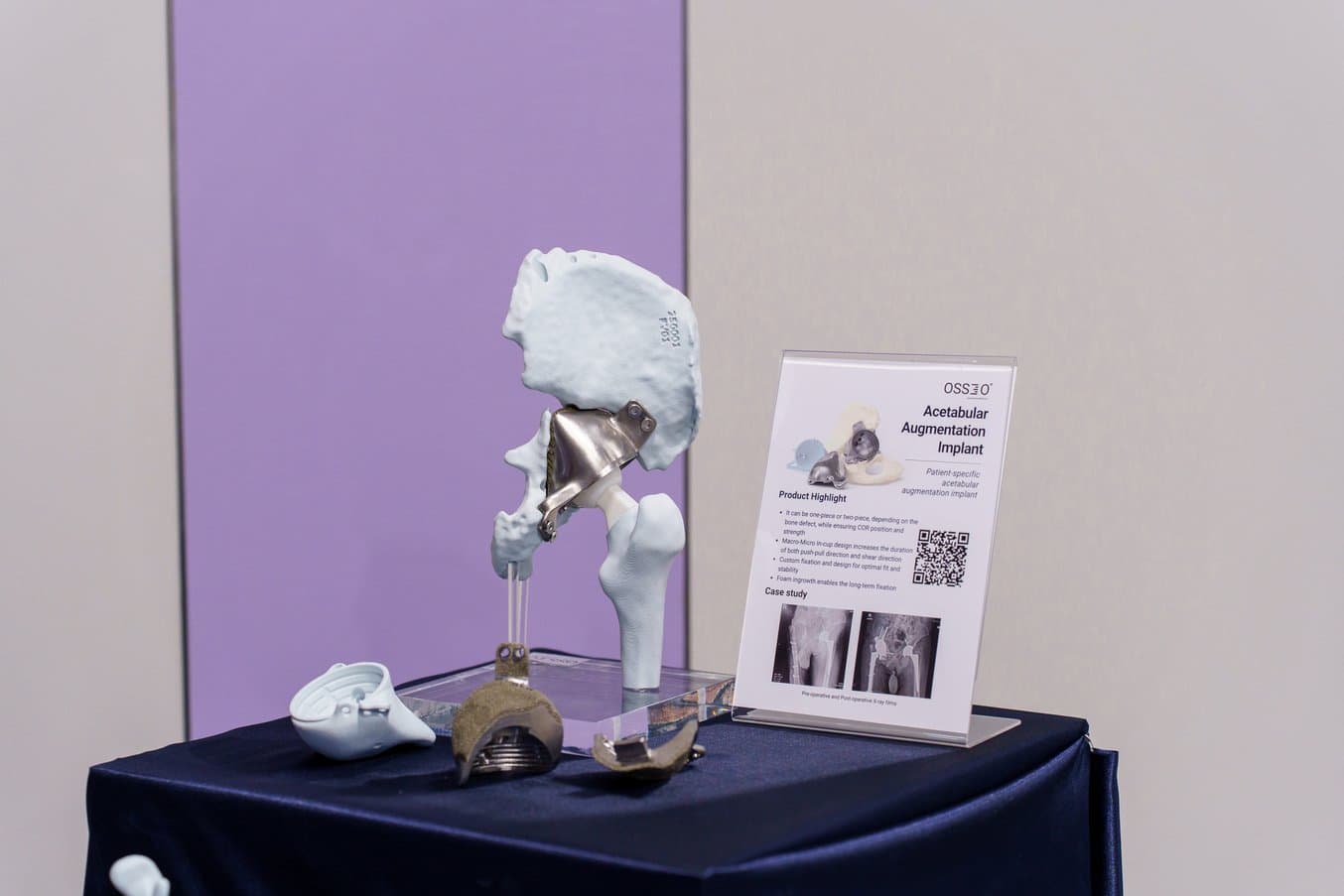3d printed model of a hip