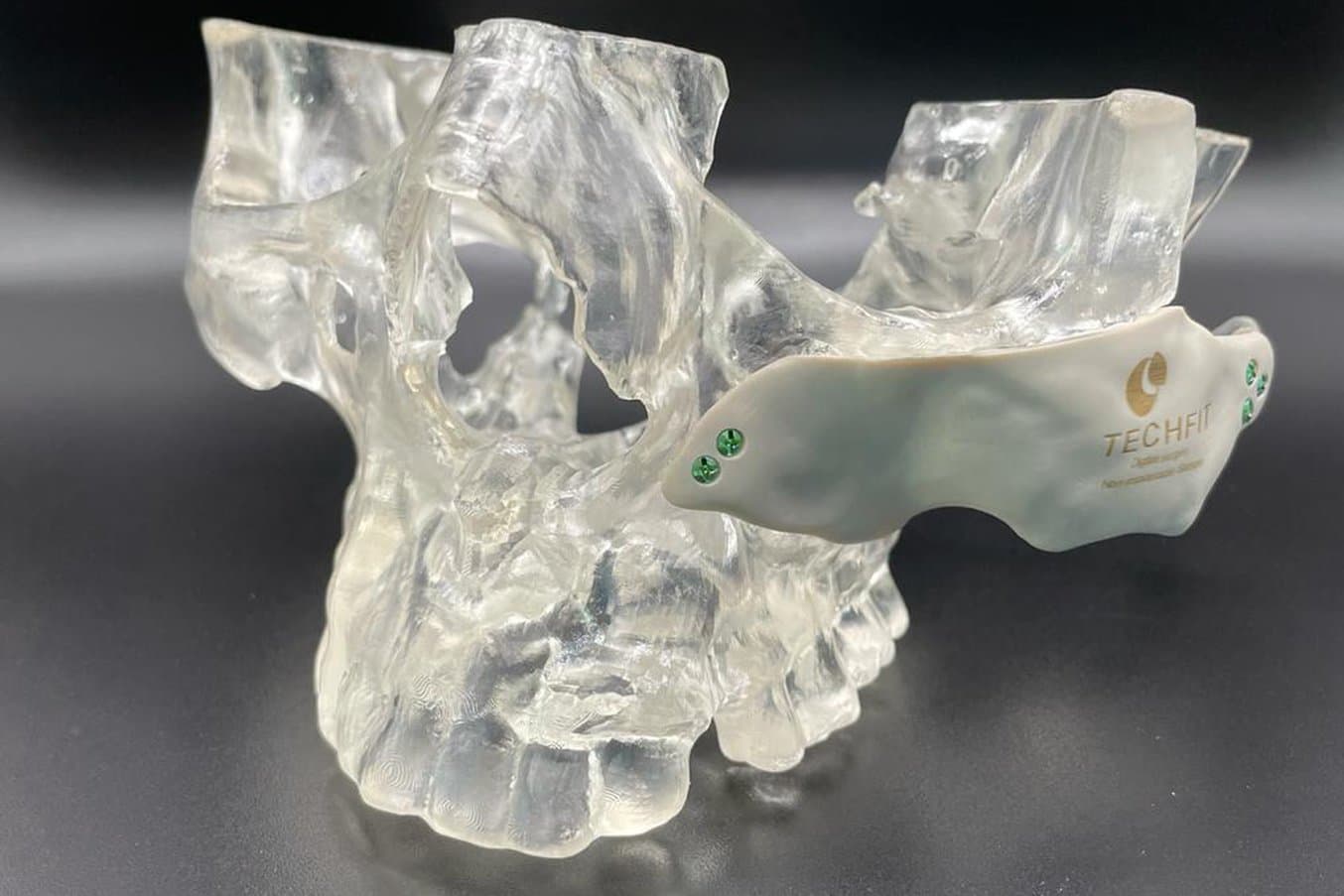 3D Printed Medical Device