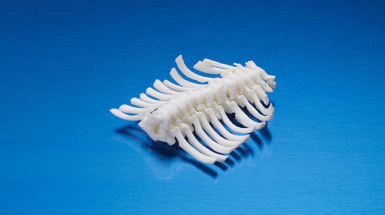 3D printing surgery