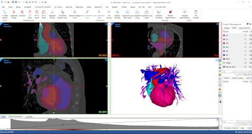 Digital image of a heart shown on CAD software screen