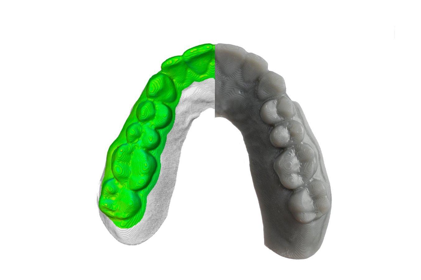 dental 3d printing resolution