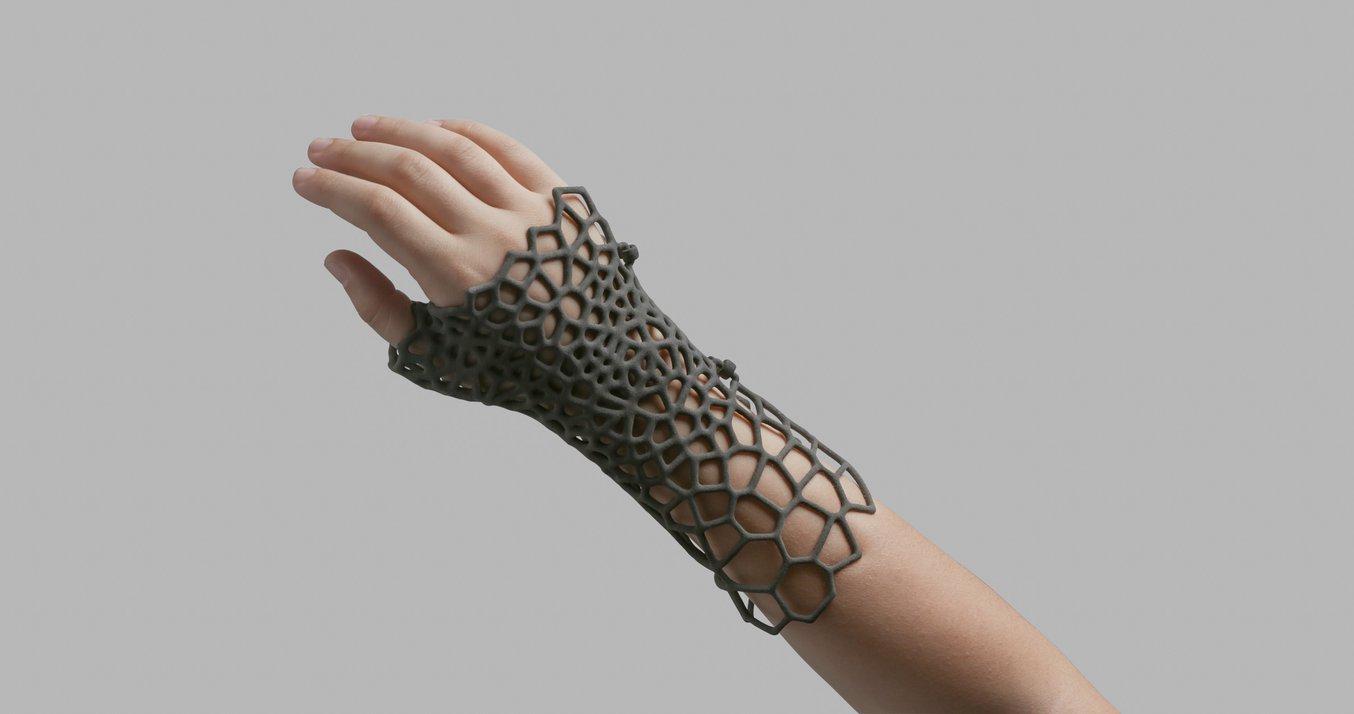 Selective Laser Sintering (SLS) - Hand splint designed with a complex pattern to reduce weight.