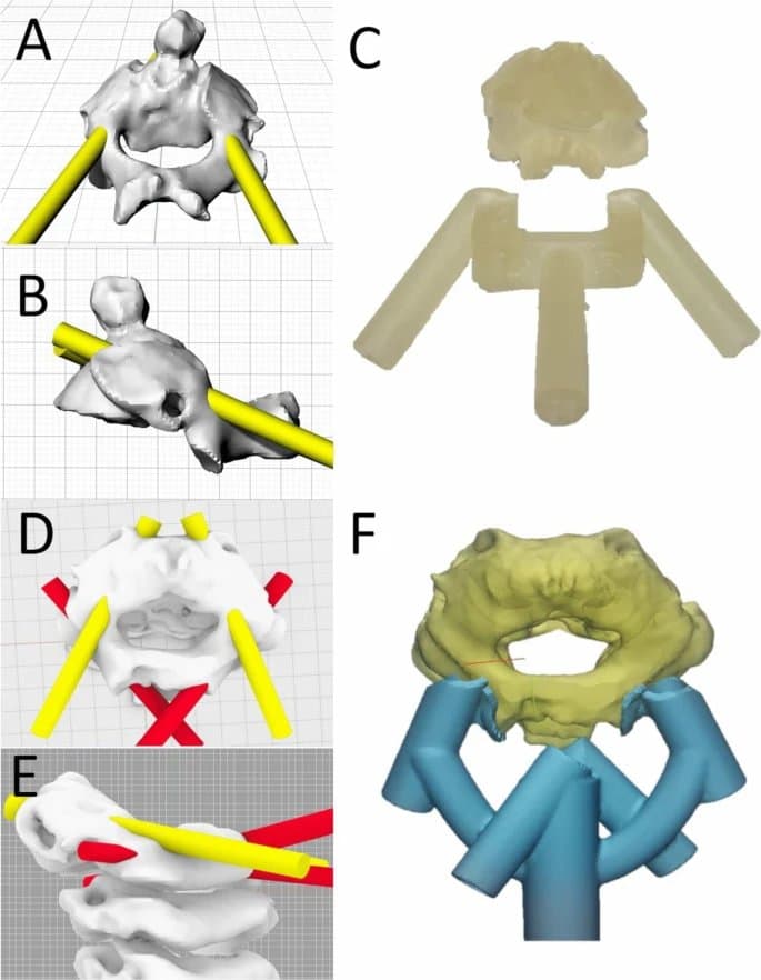 3D reconstruction of C2